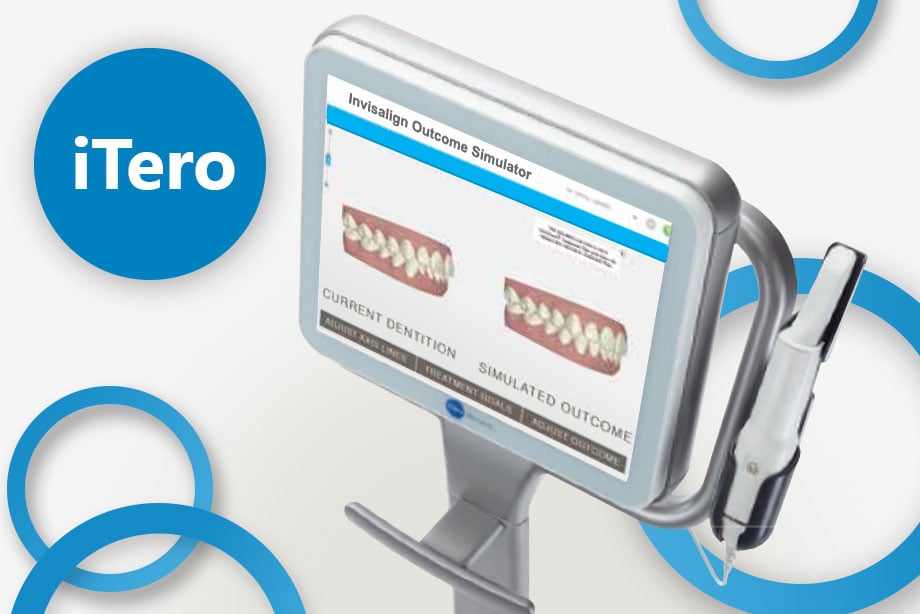 iTero Scanner picture